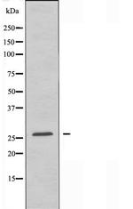 Claudin 6 Antibody in Western Blot (WB)