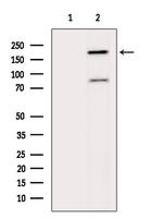 GCP6 Antibody in Western Blot (WB)