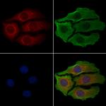 GSTT1 Antibody in Immunocytochemistry (ICC/IF)