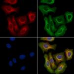 MT-ND5 Antibody in Immunocytochemistry (ICC/IF)