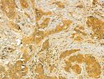 MT-ND5 Antibody in Immunohistochemistry (Paraffin) (IHC (P))