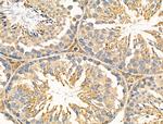 NEGR1 Antibody in Immunohistochemistry (Paraffin) (IHC (P))