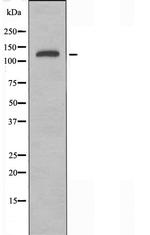 NUP160 Antibody in Western Blot (WB)