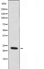 TRAPPC3 Antibody in Western Blot (WB)