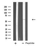 PTGIS Antibody in Western Blot (WB)