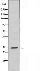 CD79a Antibody in Western Blot (WB)