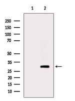 OR4F4 Antibody in Western Blot (WB)