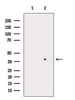 OR5M1/OR5M10 Antibody in Western Blot (WB)