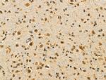 NUDT6 Antibody in Immunohistochemistry (Paraffin) (IHC (P))