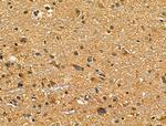 NUDT6 Antibody in Immunohistochemistry (Paraffin) (IHC (P))