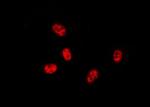 cIAP1 Antibody in Immunocytochemistry (ICC/IF)