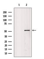 GSS Antibody in Western Blot (WB)