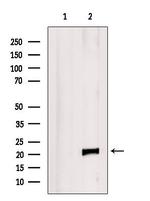 RAC2 Antibody in Western Blot (WB)