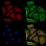 RAC2 Antibody in Immunocytochemistry (ICC/IF)