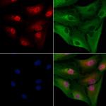 SRSF1 Antibody in Immunocytochemistry (ICC/IF)