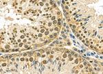 PTHLH Antibody in Immunohistochemistry (Paraffin) (IHC (P))