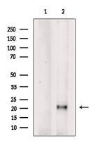 PTHLH Antibody in Western Blot (WB)