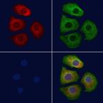 Luteinizing Hormone-beta Antibody in Immunocytochemistry (ICC/IF)