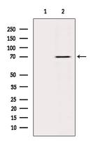 Lamin B Receptor Antibody in Western Blot (WB)