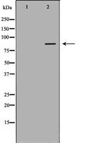 PFKM Antibody in Western Blot (WB)