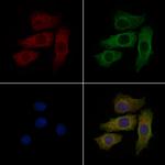 S100A11 Antibody in Immunocytochemistry (ICC/IF)