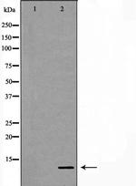 S100A11 Antibody in Western Blot (WB)