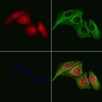 UBD Antibody in Immunocytochemistry (ICC/IF)