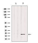 UBD Antibody in Western Blot (WB)