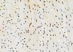 UBD Antibody in Immunohistochemistry (Paraffin) (IHC (P))