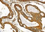 PGRMC1 Antibody in Immunohistochemistry (Paraffin) (IHC (P))