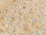 Phospho-Doublecortin (Ser335) Antibody in Immunohistochemistry (Paraffin) (IHC (P))