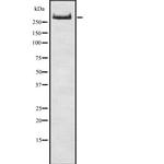 Thyroglobulin Antibody in Western Blot (WB)