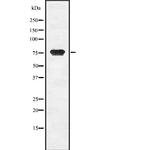 hCG beta-2 Antibody in Western Blot (WB)