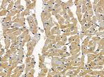 TRIP10 Antibody in Immunohistochemistry (Paraffin) (IHC (P))