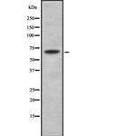 TRIP10 Antibody in Western Blot (WB)