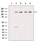 HDLBP Antibody in Western Blot (WB)