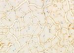 GFPT1 Antibody in Immunohistochemistry (Paraffin) (IHC (P))