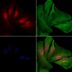 UBE2M Antibody in Immunocytochemistry (ICC/IF)