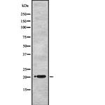 UBE2M Antibody in Western Blot (WB)