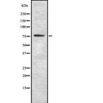 OS9 Antibody in Western Blot (WB)