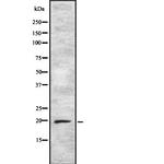 ARF5 Antibody in Western Blot (WB)