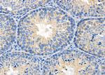 CTPS Antibody in Immunohistochemistry (Paraffin) (IHC (P))