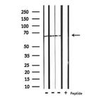 CTPS Antibody in Western Blot (WB)