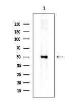 IL20RA Antibody in Western Blot (WB)