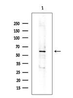 IL20RA Antibody in Western Blot (WB)