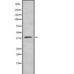 Pepsin A Antibody in Western Blot (WB)