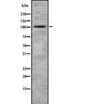 alpha Actinin 1/2/3/4 Antibody in Western Blot (WB)