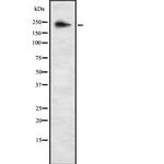 ALPK3 Antibody in Western Blot (WB)