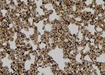 Cyclin B2 Antibody in Immunohistochemistry (Paraffin) (IHC (P))