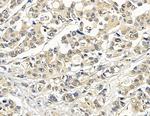 PSMD9 Antibody in Immunohistochemistry (Paraffin) (IHC (P))